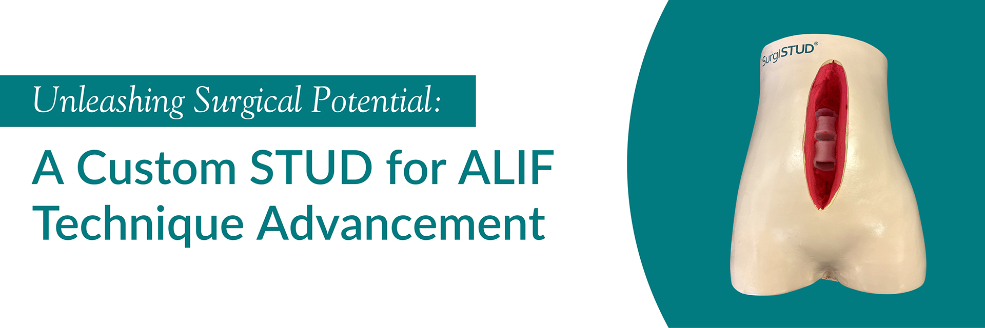 Unleashing Surgical Potential: A Custom STUD for ALIF Technique Advancement