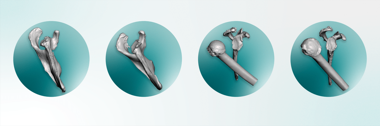 Unparalleled Custom Surgical Models for Diverse Needs